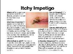 Itchy Impetigo